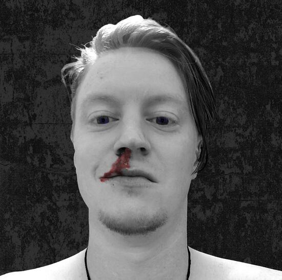 An image of Terracons member Dr Haydens face from the shoulders up, staring directly front on, with blood comming out of nose. black and white image, red blood.